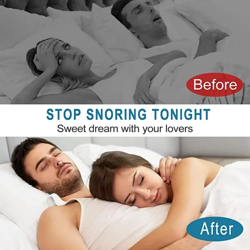 Anti Snoring Device